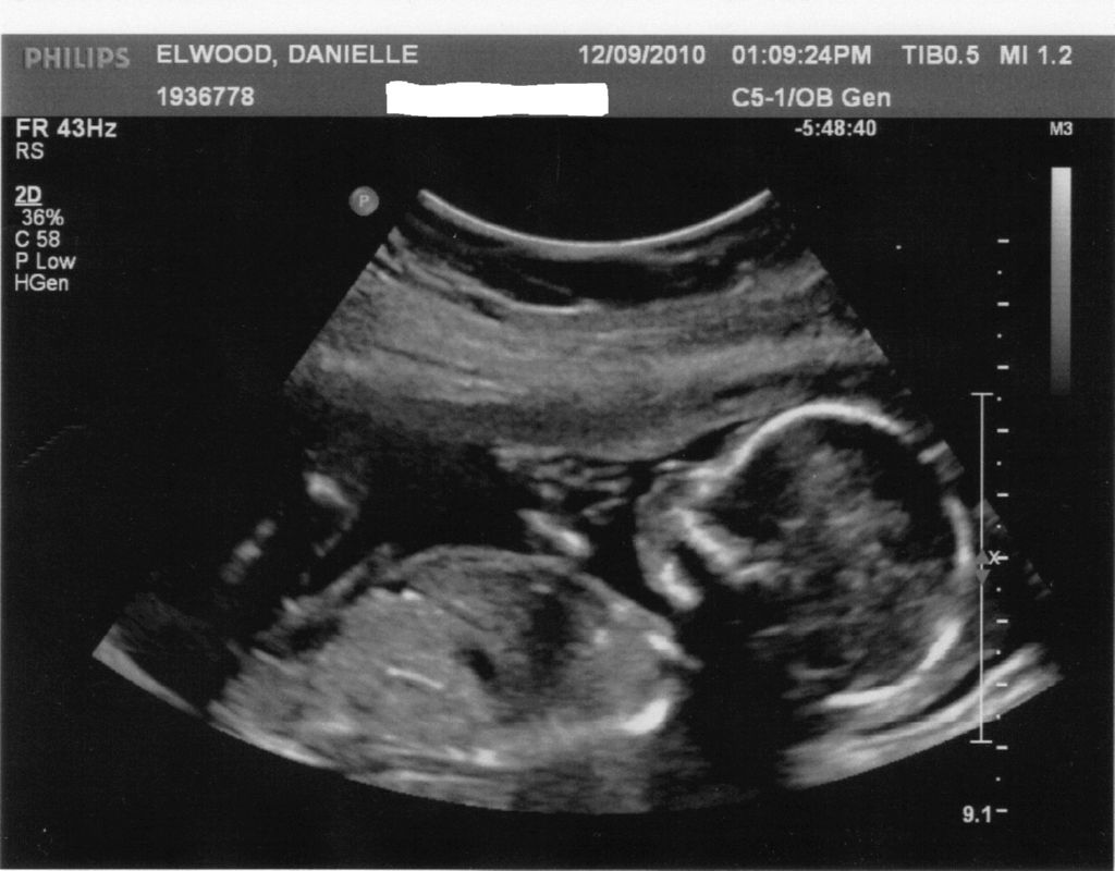 Qué hace el bebé en cada etapa del embarazo fotografo-bebes.es